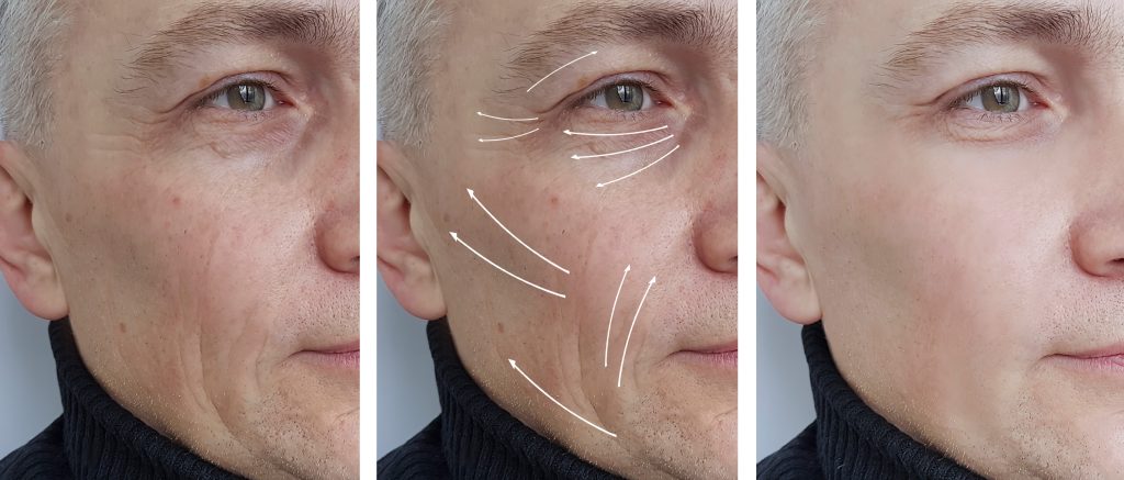 Men’s Aesthetic Treatments